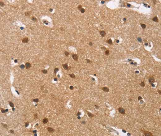 Anti-Human/Rat Cav1.3 Antibody