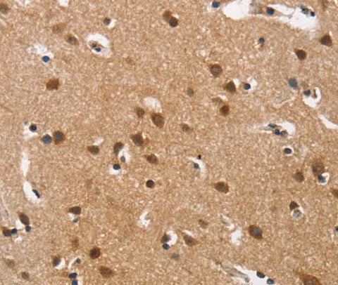 Anti-Human/Rat Cav1.3 Antibody - ABMIUM