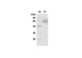 SDS-PAGE analysis of Mouse CD30 Ligand/TNFSF8 proteins , 2 μg/lane of Recombinant Mouse CD30 Ligand/TNFSF8 proteins was resolved with SDS-PAGE under reducing conditions , showing bands at 55-65 kDa.