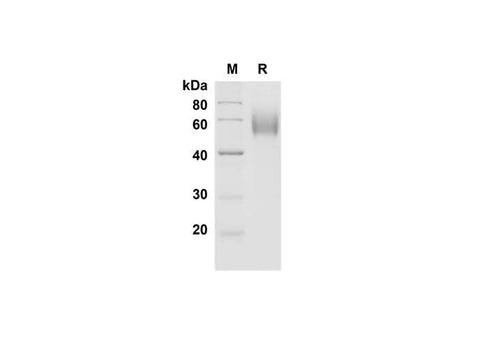SDS-PAGE analysis of Mouse CD30 Ligand/TNFSF8 proteins , 2 μg/lane of Recombinant Mouse CD30 Ligand/TNFSF8 proteins was resolved with SDS-PAGE under reducing conditions , showing bands at 55-65 kDa.