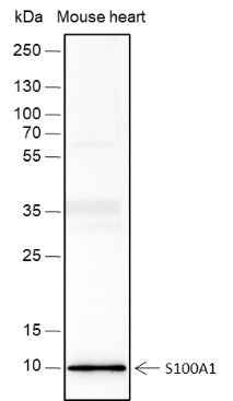 Anti-Human/Mouse S100A1 Antibody [A415] - ABMIUM