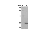SDS-PAGE analysis of Mouse CXCL1 proteins, 2 μg/lane of Recombinant Mouse CXCL1 proteins was resolved with SDS-PAGE under reducing conditions, showing bands at 28 kDa.