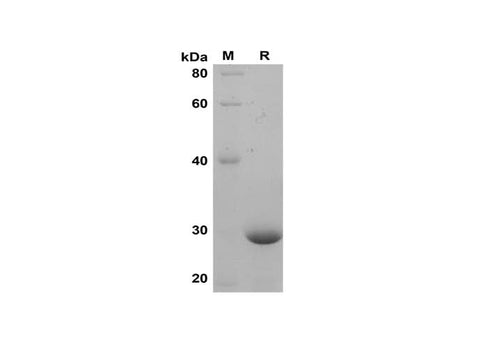 SDS-PAGE analysis of Mouse CXCL1 proteins, 2 μg/lane of Recombinant Mouse CXCL1 proteins was resolved with SDS-PAGE under reducing conditions, showing bands at 28 kDa.