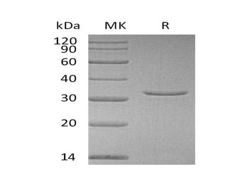 Recombinant Human VSNL1 Protein (His Tag) - ABMIUM
