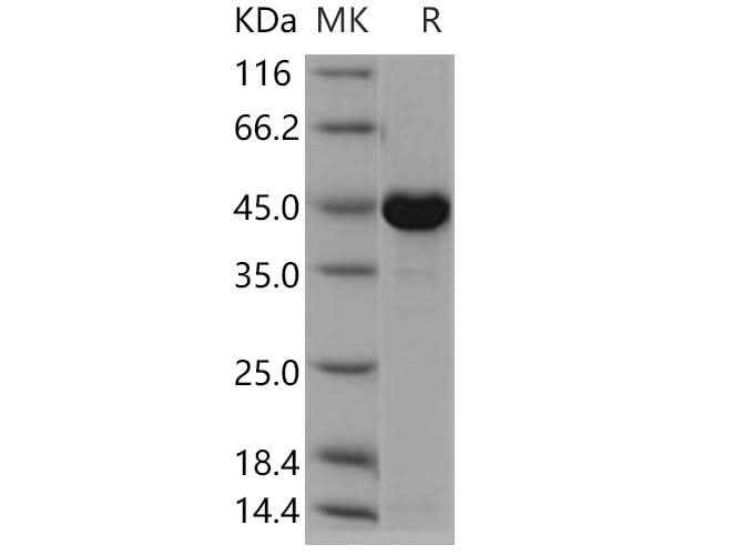 Recombinant Human CKMT1A Protein (His Tag) - ABMIUM