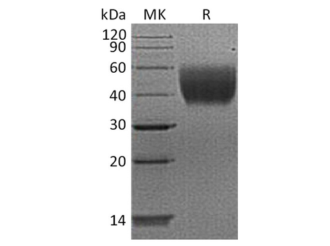 Recombinant Human IL10-RA/IL-10 Rα Protein (His Tag) - ABMIUM