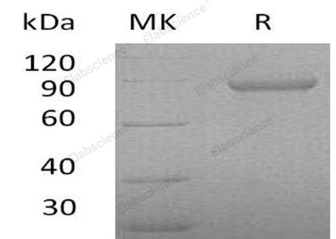 Recombinant Human Periostin/OSF-2 Protein (His Tag) - ABMIUM