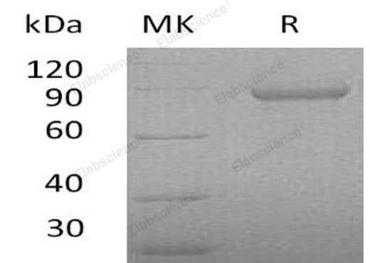 Recombinant Human Periostin/OSF-2 Protein (His Tag) - ABMIUM