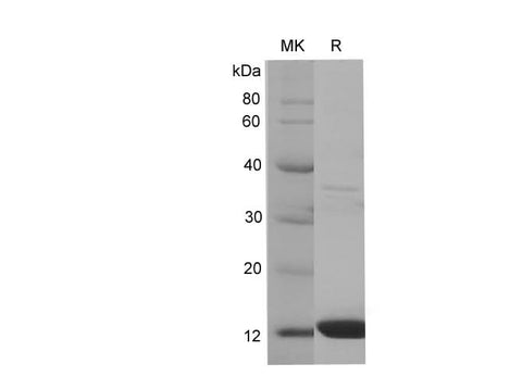 SDS-PAGE analysis of Human B2M/β2-MG proteins, 2 μg/lane of Recombinant Human B2M/β2-MG proteins was resolved with SDS-PAGE under reducing conditions, showing bands at 13.1 kDa.