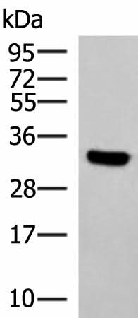 Western blot analysis of Hela cell lysate using KCTD7 Polyclonal Antibody at dilution of 1:1200