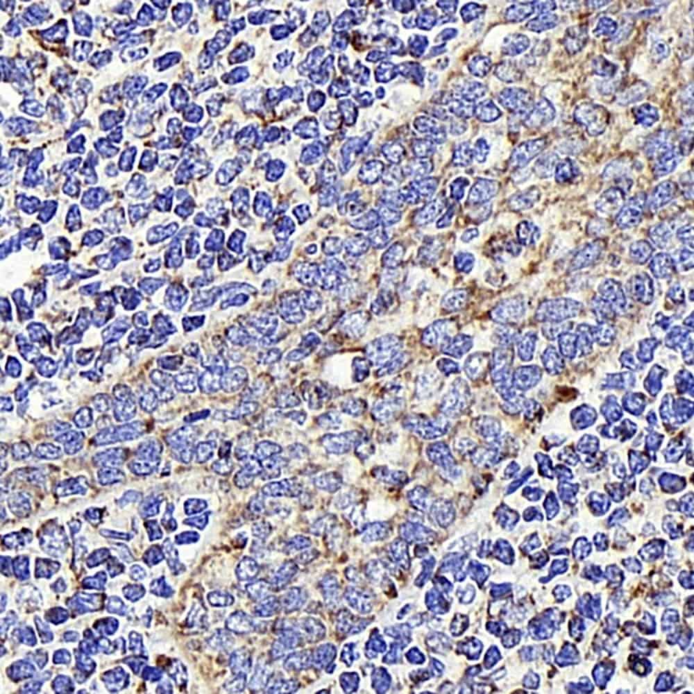 Immunohistochemistry analysis of paraffin-embedded human Tonsil using AIFM1 Polyclonal Antibody at dilution of 1:400.