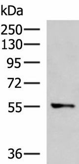 Western blot analysis of A172 cell lysate using TEKT5 Polyclonal Antibody at dilution of 1:800