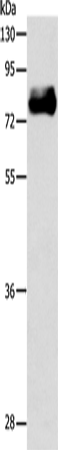 Anti-Human/Mouse ABLIM1 Antibody - ABMIUM