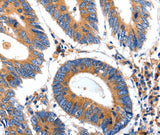 Anti-Human/Mouse IGFBP7 Antibody - ABMIUM