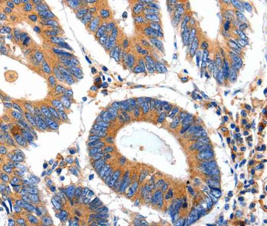 Anti-Human/Mouse IGFBP7 Antibody
