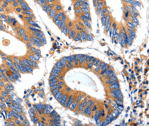 Anti-Human/Mouse IGFBP7 Antibody - ABMIUM