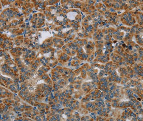 Anti-Human HSD17B14 Antibody - ABMIUM