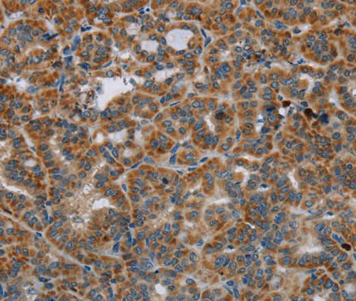 Anti-Human HSD17B14 Antibody - ABMIUM