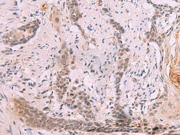 Anti-Human/Mouse INO80 Antibody