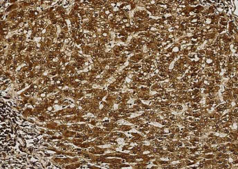 Anti-Human AK2 Antibody [A1233] - ABMIUM