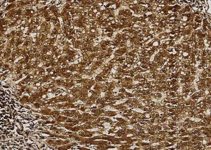 Anti-Human AK2 Antibody [A1233] - ABMIUM