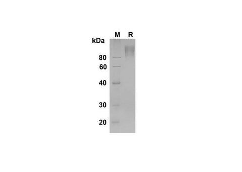 SDS-PAGE analysis of Rat CEACAM-1/CD66a proteins , 2 μg/lane of Recombinant Rat CEACAM-1/CD66a proteins was resolved with SDS-PAGE under reducing conditions , showing bands at 90 kDa.