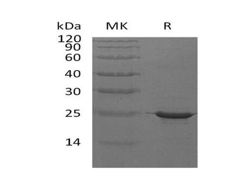 Recombinant Human CRYAB Protein (His Tag) - ABMIUM