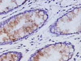 Anti-Human MUC2 Antibody - ABMIUM