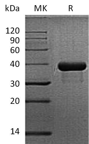 Recombinant Mouse Osteonectin/SPARC Protein (His Tag) - ABMIUM