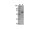 SDS-PAGE analysis of Mouse SCF proteins, 2 μg/lane of Recombinant Mouse SCF proteins was resolved with SDS-PAGE under reducing conditions, showing bands at 45-60 kDa.