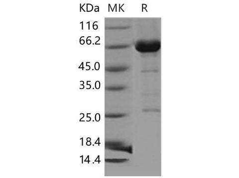 Recombinant Mouse CDC37/CDC37A Protein (His & GST Tag) - ABMIUM