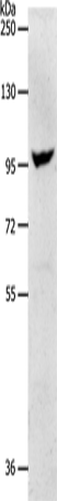 Anti-Human/Mouse NFATC2 Antibody - ABMIUM