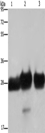 Anti-Human/Mouse/Rat FHL1 Antibody - ABMIUM