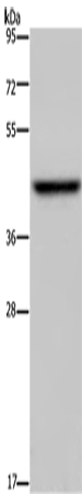 Anti-Human/Mouse/Rat ENTPD5 Antibody - ABMIUM