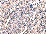 Immunohistochemistry of paraffin-embedded Human tonsil tissue using LDHAL6B Polyclonal Antibody at dilution of 1:60(×200)
