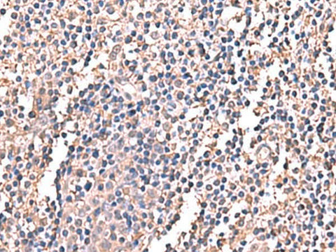 Immunohistochemistry of paraffin-embedded Human tonsil tissue using LDHAL6B Polyclonal Antibody at dilution of 1:60(×200)