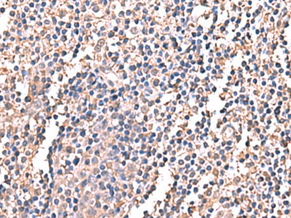 Immunohistochemistry of paraffin-embedded Human tonsil tissue using LDHAL6B Polyclonal Antibody at dilution of 1:60(×200)