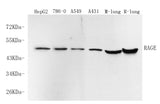 Western Blot analysis of various samples using RAGE Polyclonal Antibody at dilution of 1:750.