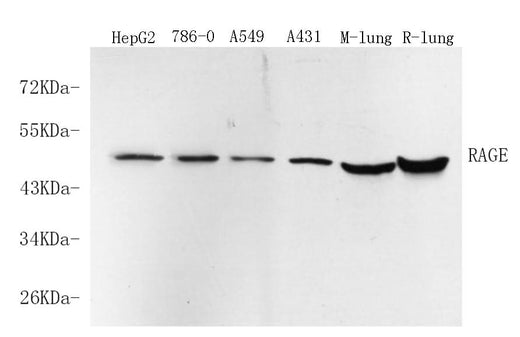 Western Blot analysis of various samples using RAGE Polyclonal Antibody at dilution of 1:750.