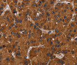 Anti-Human/Mouse/Rat NPHS2 Antibody - ABMIUM