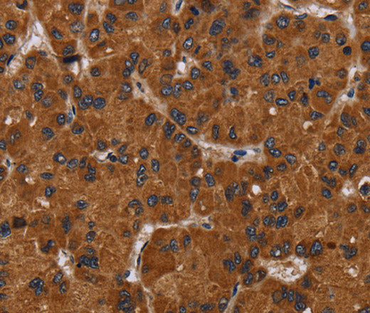 Anti-Human/Mouse/Rat NPHS2 Antibody - ABMIUM
