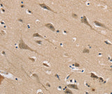 Anti-Human DLG2 Antibody - ABMIUM