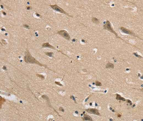 Anti-Human DLG2 Antibody