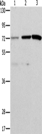 Anti-Human/Mouse ALS2CR11 Antibody - ABMIUM
