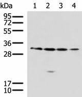 Western blot analysis of 293T A549 Jurkat 231 cell lysates using RCHY1 Polyclonal Antibody at dilution of 1:650