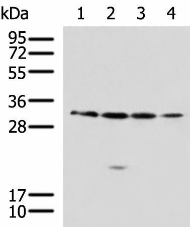 Western blot analysis of 293T A549 Jurkat 231 cell lysates using RCHY1 Polyclonal Antibody at dilution of 1:650