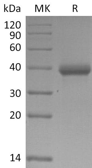 Recombinant SARS-CoV-2 Spike RBD-SD1(W436R)(His Tag) - ABMIUM