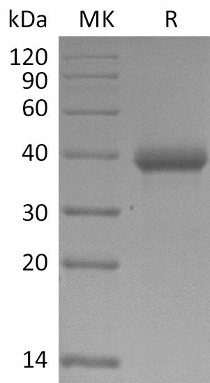 Recombinant SARS-CoV-2 Spike RBD-SD1(W436R)(His Tag) - ABMIUM