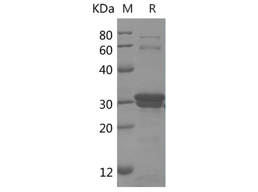 SDS-PAGE analysis of Human DEFβ2/DEFB2 proteins, 2 μg/lane of Recombinant Human DEFβ2/DEFB2 proteins was resolved with SDS-PAGE under reducing conditions, showing bands at 33 kDa.