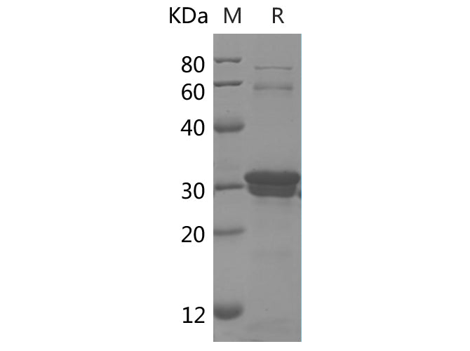 SDS-PAGE analysis of Human DEFβ2/DEFB2 proteins, 2 μg/lane of Recombinant Human DEFβ2/DEFB2 proteins was resolved with SDS-PAGE under reducing conditions, showing bands at 33 kDa.